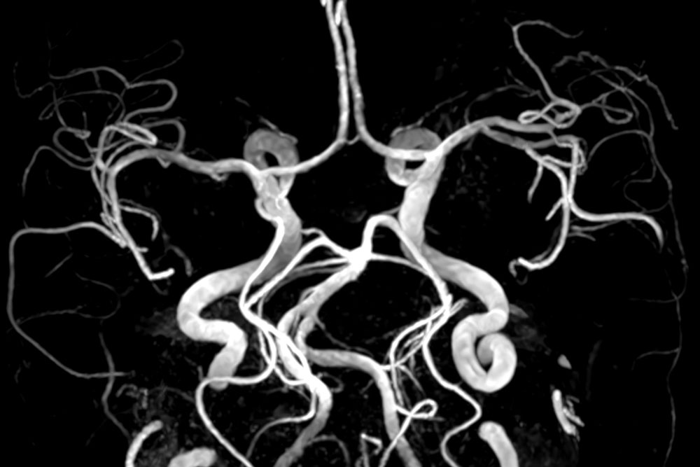radiologie-kiel-zentrum-Kardiovaskuläre-Bildgebung radiologie-kiel-zentrum-Kardiovaskuläre-Bildgebung